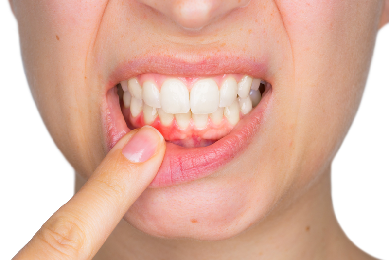 Closeup of a young woman showing with her finger inflamed lower gingiva with expression of pain